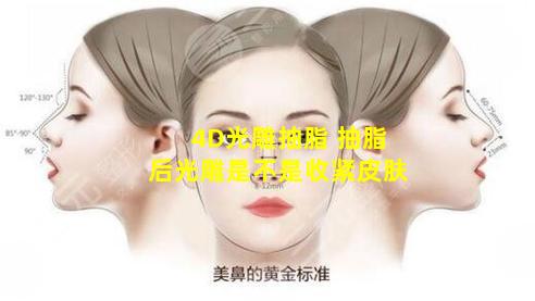 4D光雕抽脂 抽脂后光雕是不是收紧皮肤